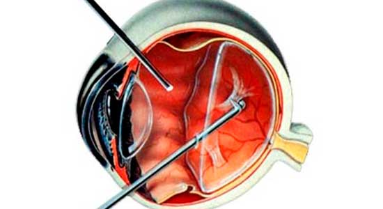 Cirurgias Clínica Cid Laser, Clínica de Olhos Cid Laser